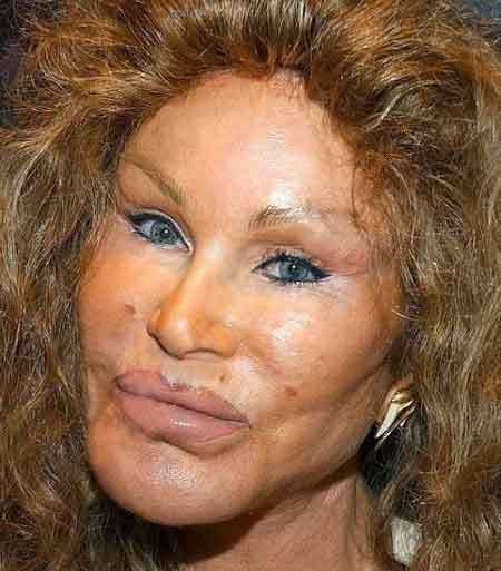 jocelyn wildenstein before surgery. undergoing plastic surgery